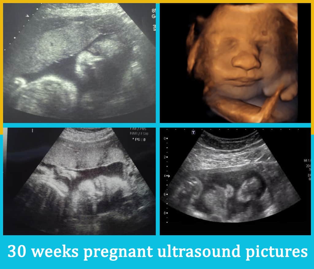 مراحل نمو الجنين في الثلث الأخير من الحمل