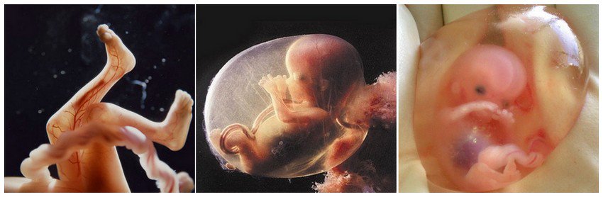 مراحل تطور الجنين الثلث الثاني من الحمل