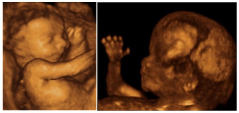 مراحل تطور الجنين خلال الثلث الثاني من الحمل 3