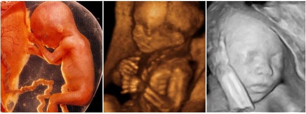 مراحل تطور الجنين خلال الثلث الثاني من الحمل 4