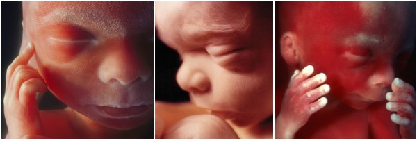 مراحل تطور الجنين خلال الثلث الثاني من الحمل 6