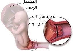 اتساع عنق الرحم أثناء الحمل 3