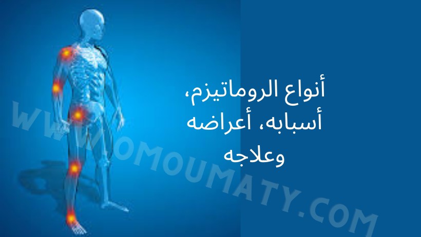 أنواع الروماتيزم، أسبابه، أعراضه وعلاجه