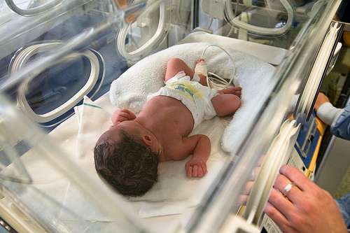 التلقيح الاصطناعي والولادة المبكرة 